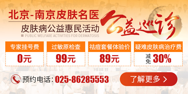 胸部白癜风的病因是什么